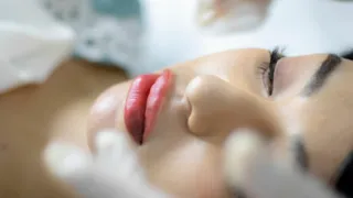 Filler labbra a Pregnana Milanese: come mantenere il risultato naturale più a lungo